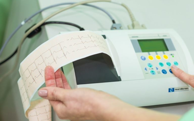 srok-godnosti-ekg-C43F5