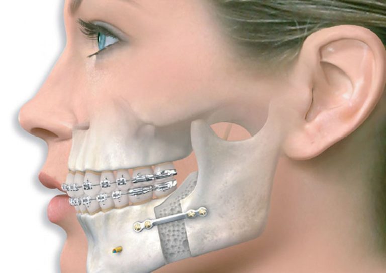 1540893978-w1200_h850_zc1_at_zgvrioxbm8jejenwnkorbd3mtqkxycuh